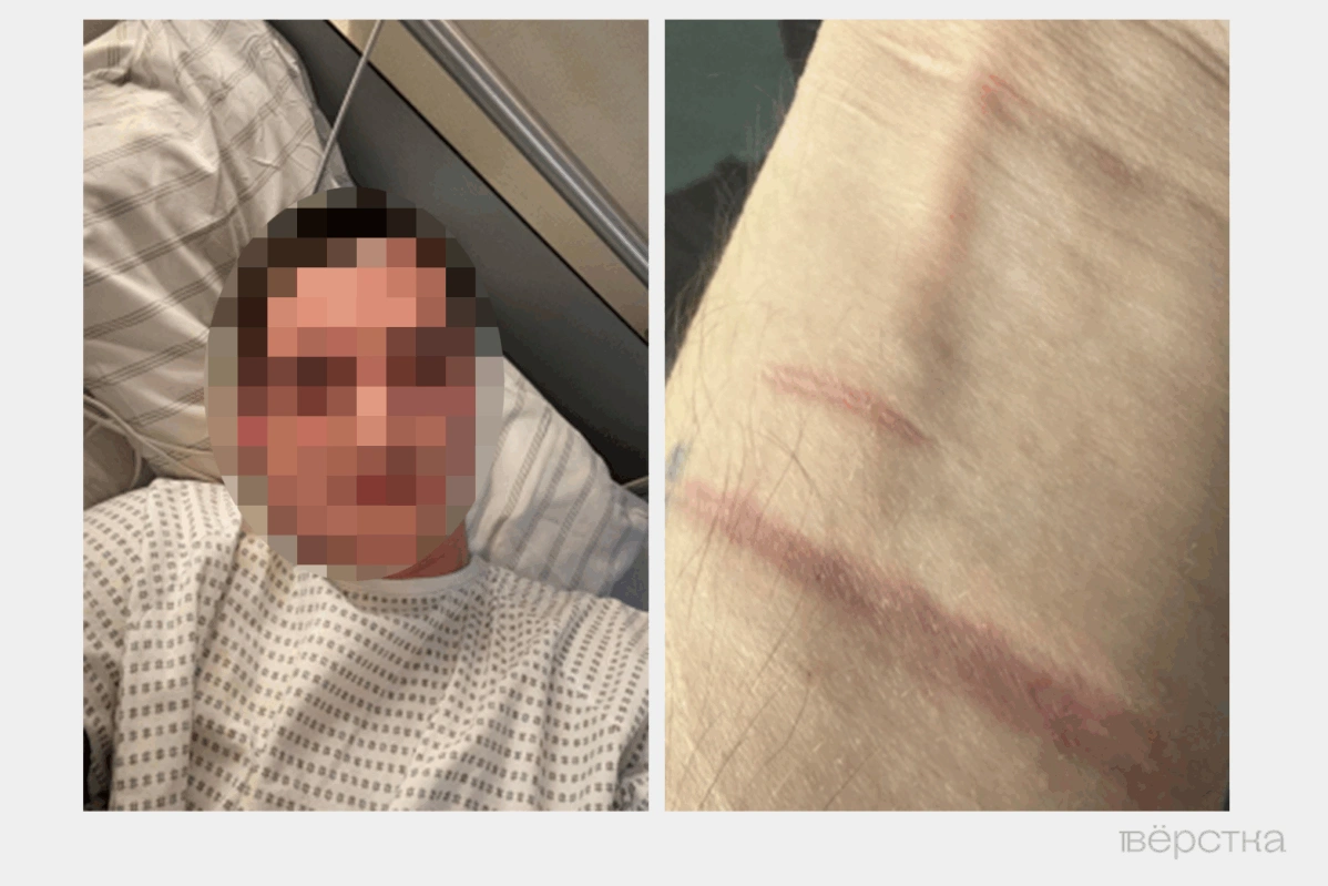 В соответствии с новым расписанием болезней психические заболевания — не повод к признанию негодными. Таких людей отправляют на фронт