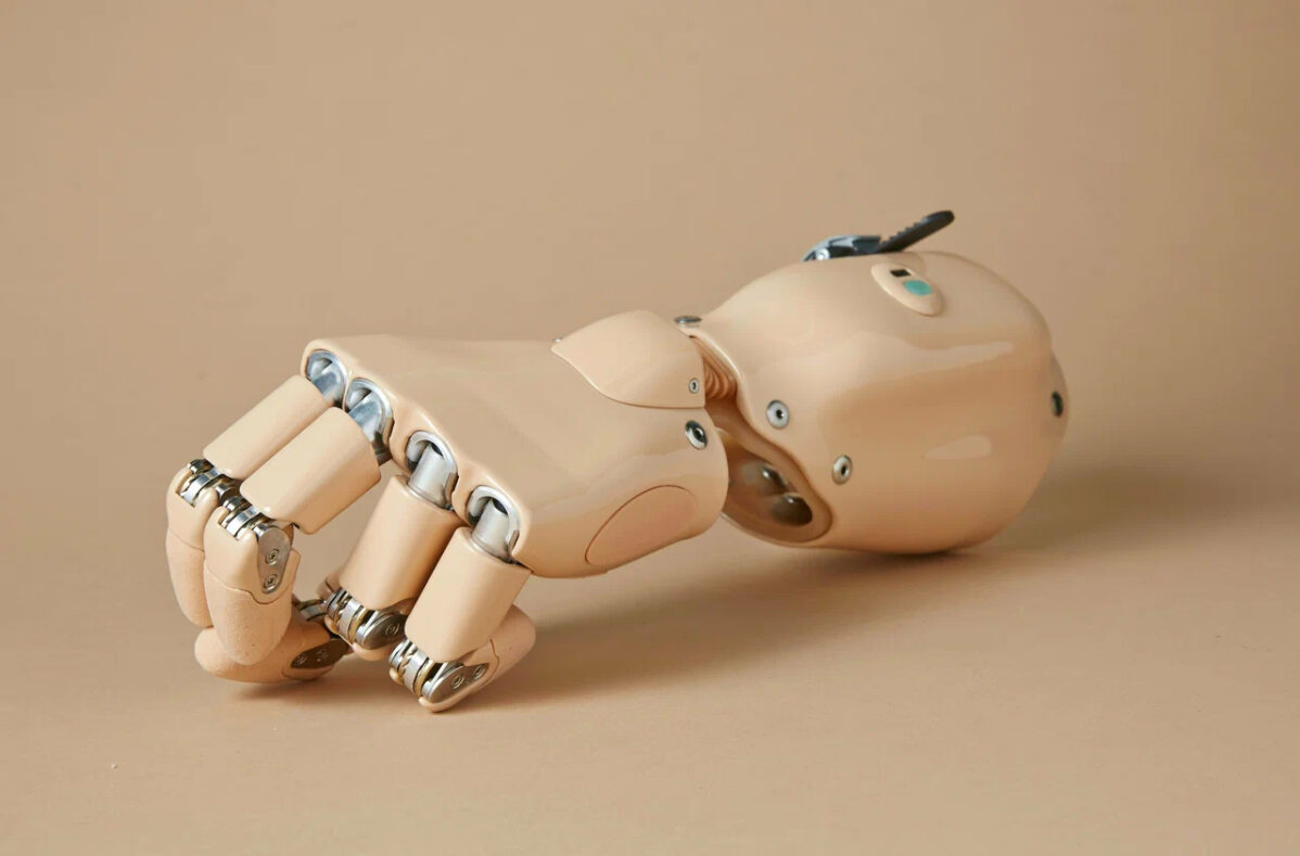 Протезы рук бывают косметическими и функциональными. Последние бывают: тяговыми и биоэлектрическими (бионическими)